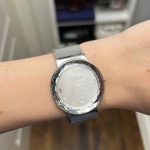 Skagen women’s watch with a flaw